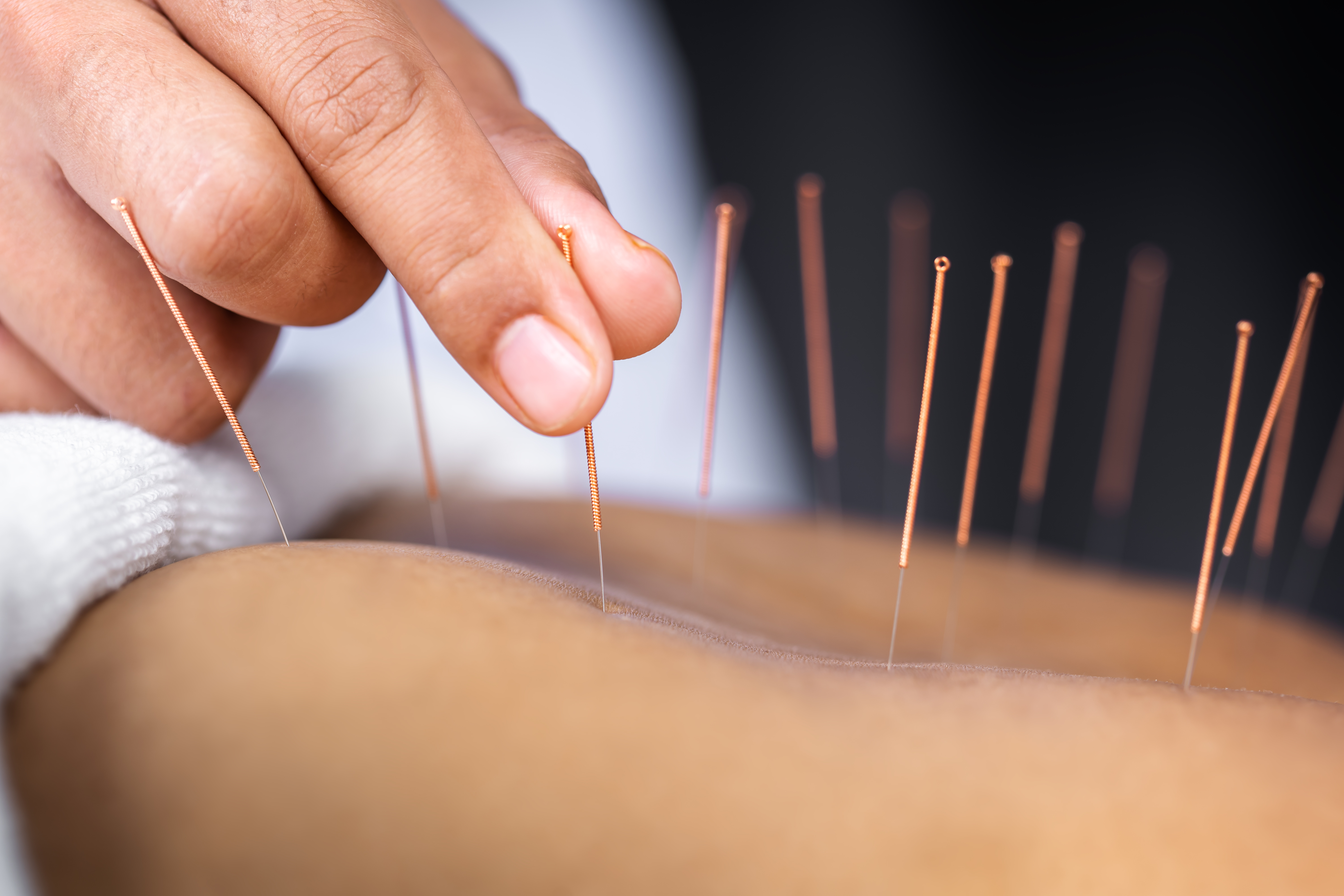 ACUPUNCTURE + MASSAGE THERAPY